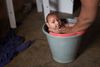 Denne lille brasilianske dreng er ramt af den frygtede Zikavirus, som er en myggeoverført sygdom, der overføres med myggearten Aedes. Der er en stærk mistanke om, at zikavirus kan give medfødt microcephali (for lille hovedudvikling) og andre skader på centralnervesystemet hos nyfødte. Sammenhængen er dog ikke endelig bevist.