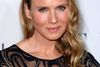 Da Rene Zellweger, alias Bridget Jones, viste sig offentligt efter sine kosmetiske operationer, blev hun voksen-mobbet på facebook.