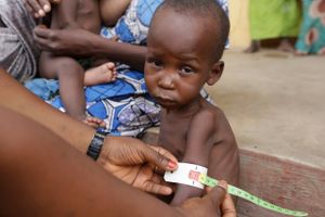 - I gennemsnit vil 134 børn dø hver dag, hvis der ikke bliver gjort noget hurtigt, siger organisationens regionale direktør for Vest- og Centralafrika, Manuel Fontaine, efter et besøg i området. Foto: Sunday Alamba/AP