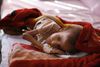 Et underernæret barn venter på behandling på et hospital i Yemen. Ofte kan hospitalerne dog ikke stille meget op. I dag er over halvdelen af landets hospitaler og sundhedsklinikker lukket ned. Der er mangel på medicin, strøm og penge. Arkivfoto: Hani Mohammed/AP