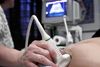 Et nyt studie viser, at jo ældre en kvinde er, når hun bliver gravid, des flere skadelige mutationer er der i dna'et i hendes æg. Opdagelsen åbner ifølge én af forskerne bag studiet op for bedre rådgivning til kvinder, som først sent i livet vælger at få børn.