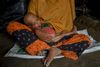 FN skønner, at over 580.000 statsløse rohingyaer er flygtet til Bangladesh, siden volden eskalerede i staten Rakhine i Myanmar 25. august. I landet var der i forvejen cirka 300.000 rohingyaer, som var flygtet dertil. Foto: Dar Yasin/AP