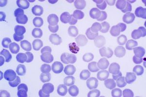 Mature_Plasmodium_malariae_schizont_PHIL_2715_lores.jpg