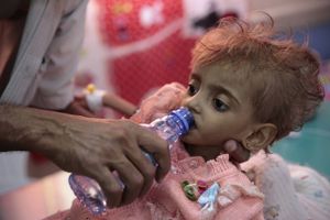 En far giver sin underernærede datter lidt vand på et hospital i Hodeida i Yemen. Foto: Hani Mohammed/AP