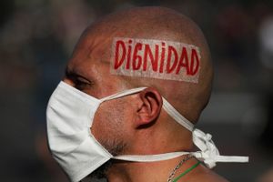 "Værdighed" står malet på hovedet af af denne mand ved en demonstration i Chiles hovedstad Santiago for en uge siden, der sammen med de foregående i de seneste tre måneder har handlet om ulighed. Foto: AP/Fernando Llano