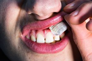 Snus, nikotinposer og tyggetobak er i større grad end tidligere at finde i mundhulen og under overlæben hos danske unge. Det viser et nyt studie fra Institut for Folkesundhed. Alarmerende udvikling, mener ekspert. 
