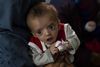 En afghansk mor holder sin baby, der behandles for fejlernæring under den tiltagende krise i det forarmede land. Pakistan og en række andre muslimske lande om, at det vil få "alvorlige følger for det internationale samfund", hvis en økonomisk nedsmeltning i Afghanistan får lov at udvikle sig til en humanitær katastrofe i Afghanistan. - Foto: Petros Giannakouris/Ritzau Scanpix