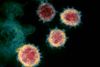 This undated transmission electron microscope image shows SARS-CoV-2, also known as novel coronavirus, the virus that causes COVID-19, isolated from a patient in the U.S. Virus particles are shown emerging from the surface of cells cultured in the lab. The spikes on the outer edge of the virus particles give coronaviruses their name, crown-like. NIAID-RML/Handout via REUTERS. THIS IMAGE HAS BEEN SUPPLIED BY A THIRD PARTY. MANDATORY CREDIT