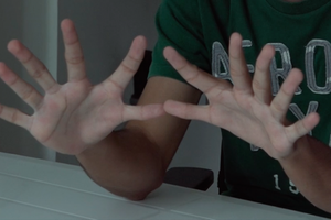To forsøgspersoner, der begge er født med seks fingre på hver hånd, har fået undersøgt deres motorik og hjernekapacitet i et nyt studie. Foto: C. Mehring, M. Akselrod, via Videnskab.dk