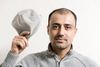 Ibrahim Korkmaz fik for to måneder siden flyttet 4500 hår fra nakken til issen.